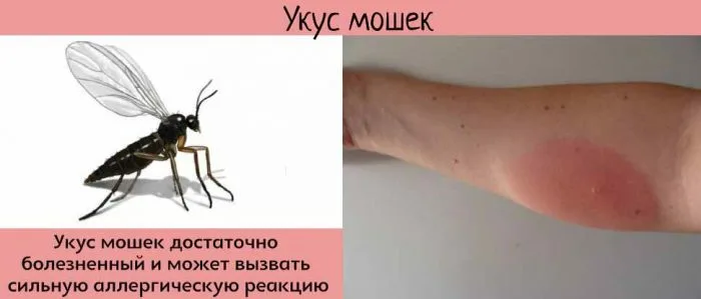 Чем убрать зуд после укуса комара