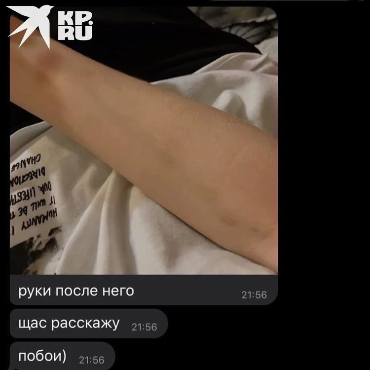 Как снять побои без синяков Друзья думали, это - розыгрыш": парень зарезал свою девушку в день ее 17-летия К