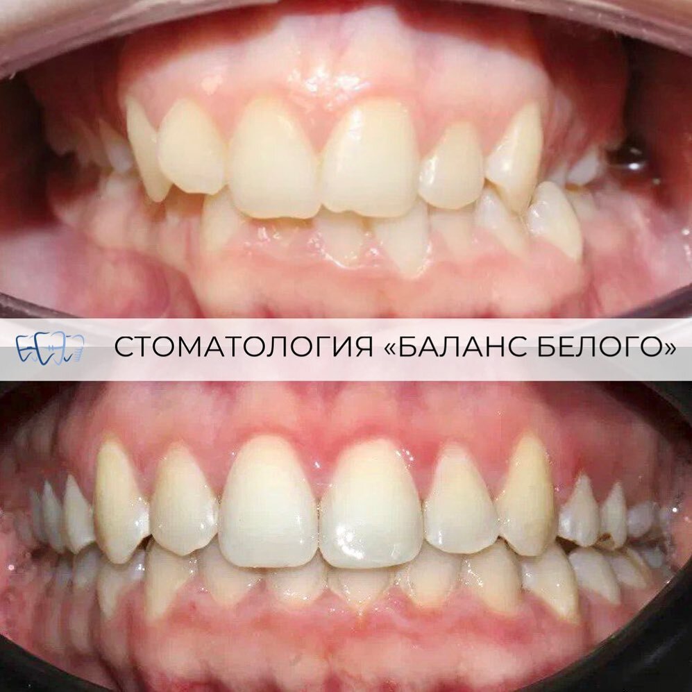 Ортодонтическое лечение в Москве