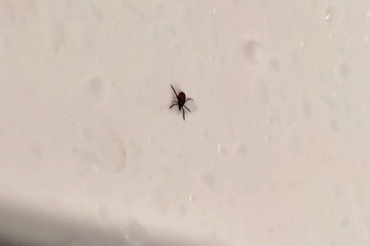    Жителям Карелии рассказали, куда обращаться за помощью после укуса клеща