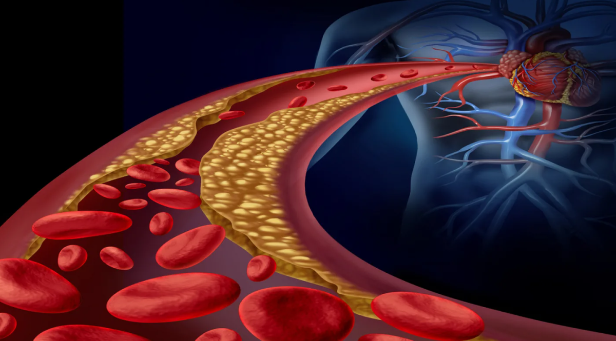 холестерин