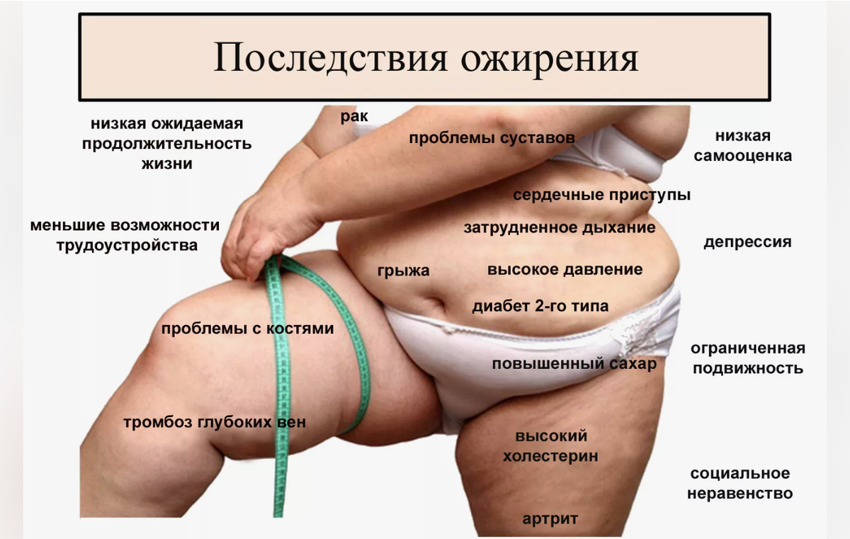 Последствия ожирения