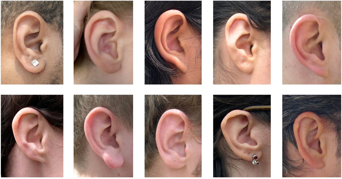 Разновидности мочек и ушных раковин