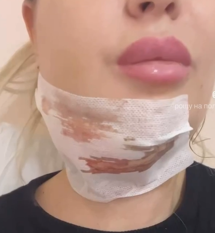 последствия