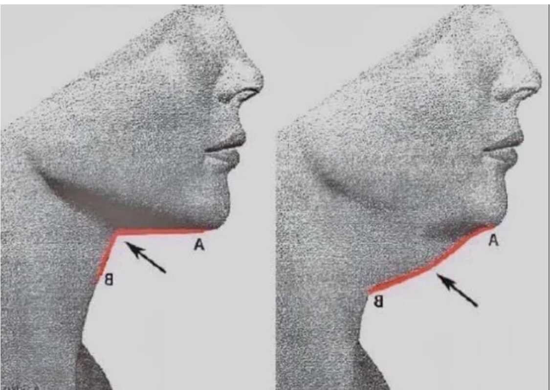Гармоничные черты лица. Прямоугольная форма лица. Подбородок и углы нижней челюсти. Сглаживать острые. Угол демотиватор.