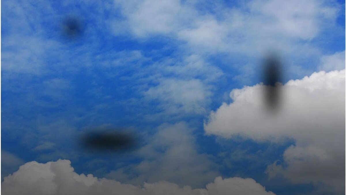 Отслойка сетчатки: признаки и способы лечения. | VISTA центр ...