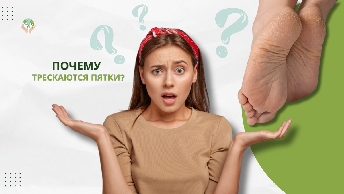 Здоровье и хорошее самочувствие: Жизнь без боли. "Почему трескаются пятки" 