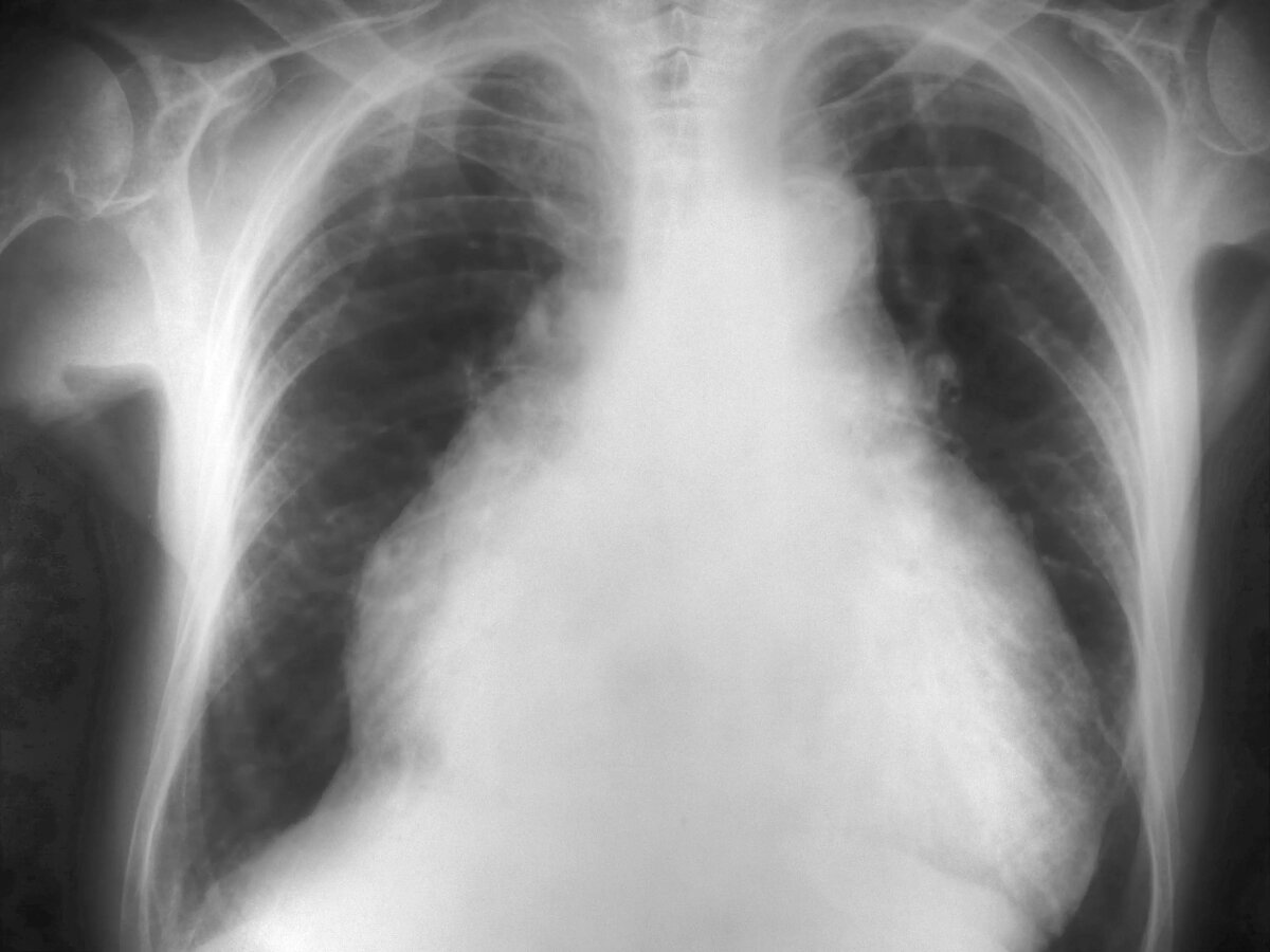     Автор: wikimedia.org