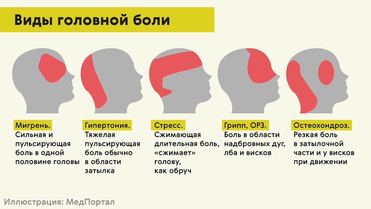 Как избавиться от головной боли с помощью йоги | Йогатерапия с Дарьей | Дзен