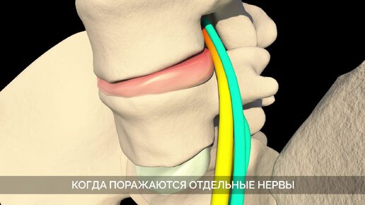 НЕМЕЮТ НОГИ? СРОЧНО БЕГИТЕ К ВРАЧУ / Почему немеют ноги и как от этого избавиться?