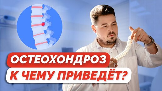 От головной боли до головокружения: симптомы, указывающие на остеохондроз. Какие последствия могут быть, если не лечить вовремя?