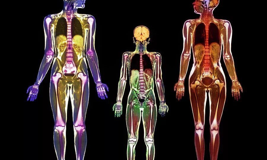 Стоит ли Вам проходить МРТ всего тела?