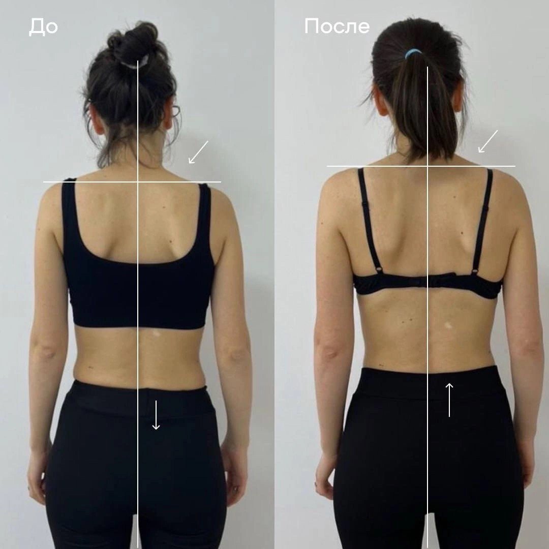 Клиника "Остео Лайт"