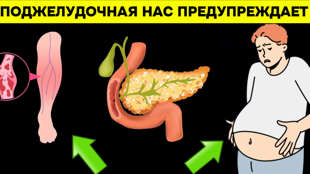 8 тревожных признаков заболевания поджелудочной железы, которые вы никогда  не должны игнорировать | Игорь Ботоговский | Дзен