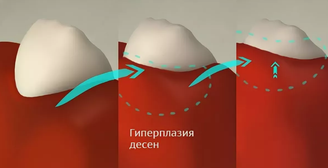 Фото: интернет