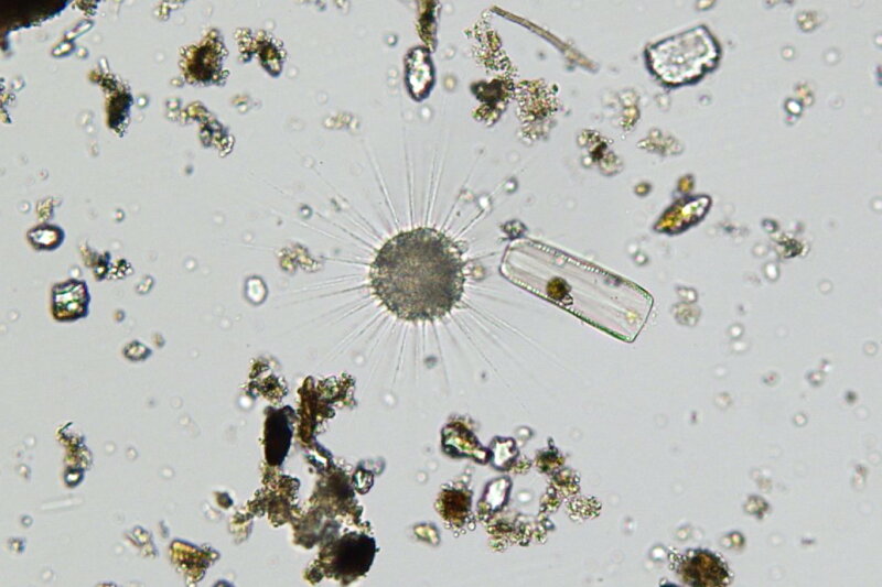 фотография с сайта https://quizlet.com/ru/421727554/%D0%A1%D0%B0%D1%80%D0%BA%D0%BE%D0%B4%D0%BE%D0%B2%D1%8B%D0%B5-sarcodina-flash-cards/