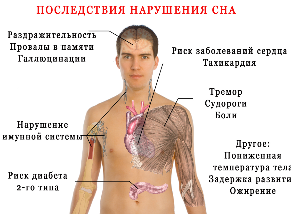 Почему мучает бессонница и какие доступные методы могут ее побороть?  Попробуйте эти советы | О здоровье: с медицинского на русский | Дзен