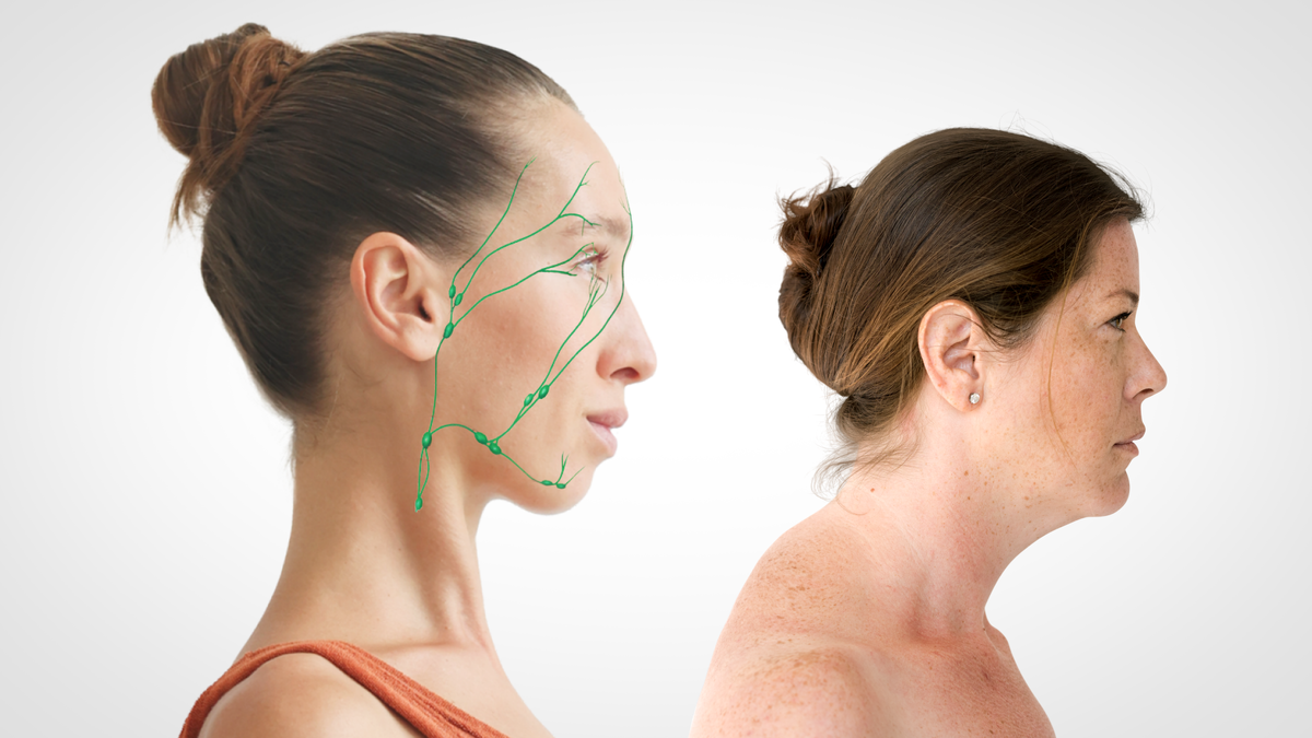 лимфатические сосуды на лице и отеки