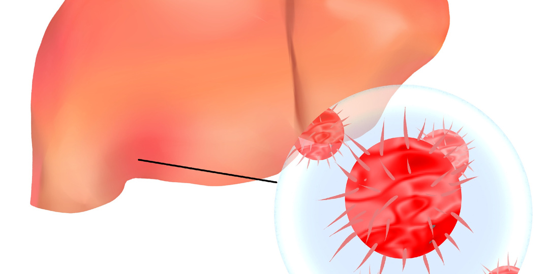 Гепатит А - нужна ли вакцина во время или после наводнения