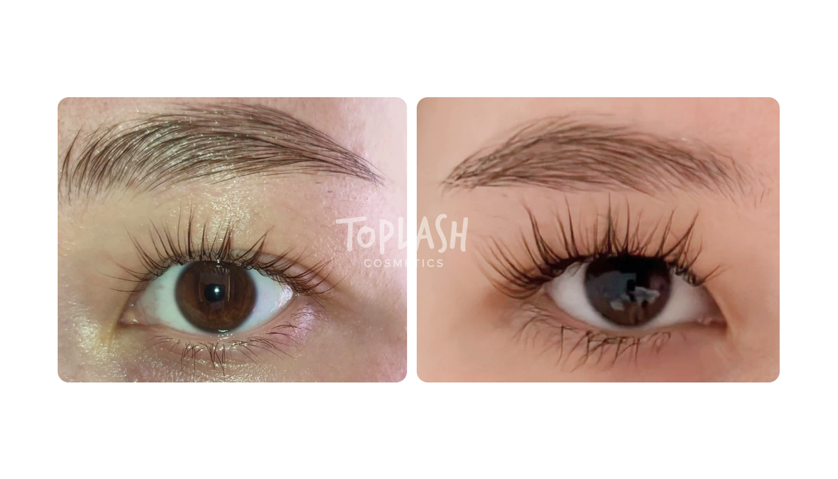 Результаты после сыворотки Toplash