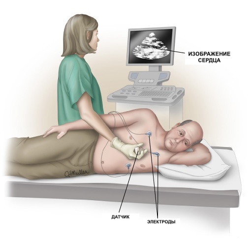 Недостаточность трикуспидального клапана