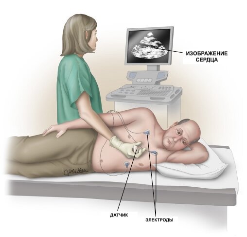 На этом снимке изображен человек, которому делают эхокардиограмму (или «эхо»). Чтобы сделать эхо, врач наносит гель на грудь человека. Они прижимают датчик к груди и перемещают ее. Эхо использует звуковые волны для создания изображений сердца, которые появляются на экране компьютера. Во время эхо проводится тест, называемый электрокардиограммой (ЭКГ). Для проведения ЭКГ к груди человека прикрепляют пластыри (называемые «электродами»). Провода идут от пластырей к машине, которая записывает электрическую активность сердца.