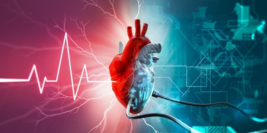 Аритмия и жизнь после РЧА (катетерной абляции) - какие правила и ограничения? И как снизить риск рецидива после операции?