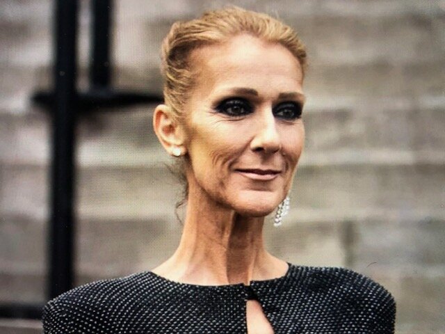 В недавнем интервью французской версии журнала Vogue Селин Дион (Celine Dion) рассказала о жизни с синдромом мышечной скованности (“stiff person syndrome” или SPS).-2