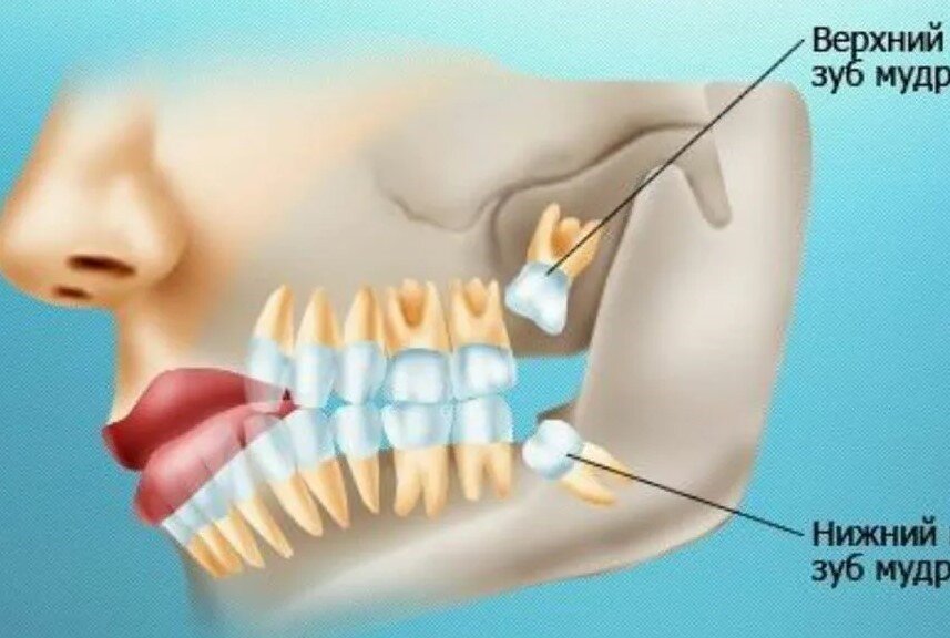 У человека вместе с зубами мудрости