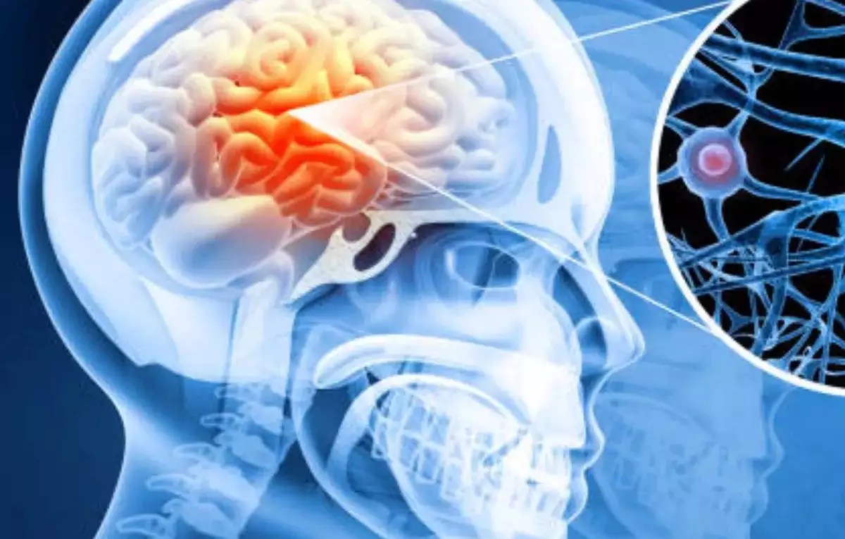 Иллюстрация: health.economictimes.indiatimes.com