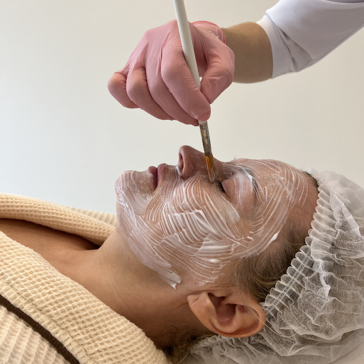 Как проходит микроигольчатый РФ лифтинг Virtue? Этап - анестезирование | сеть клиник косметологии GEN87