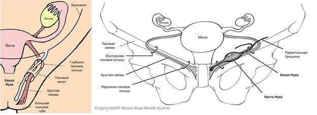 Рис. 1. Схема формирования канала Нука и кисты Нука