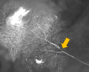 Рис. 1. Сиалограмма околоушной железы. Определяется участок сужения протока I порядка.