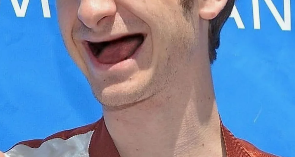 Тоже рад, не подошёл съёмный - подойдут импланнтаты. Из открытых источников сети интернет.