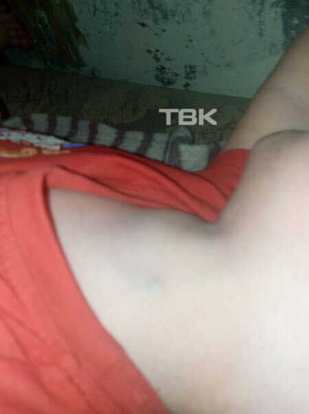 Так выглядят воспаленные лимфоузлы ребенка.