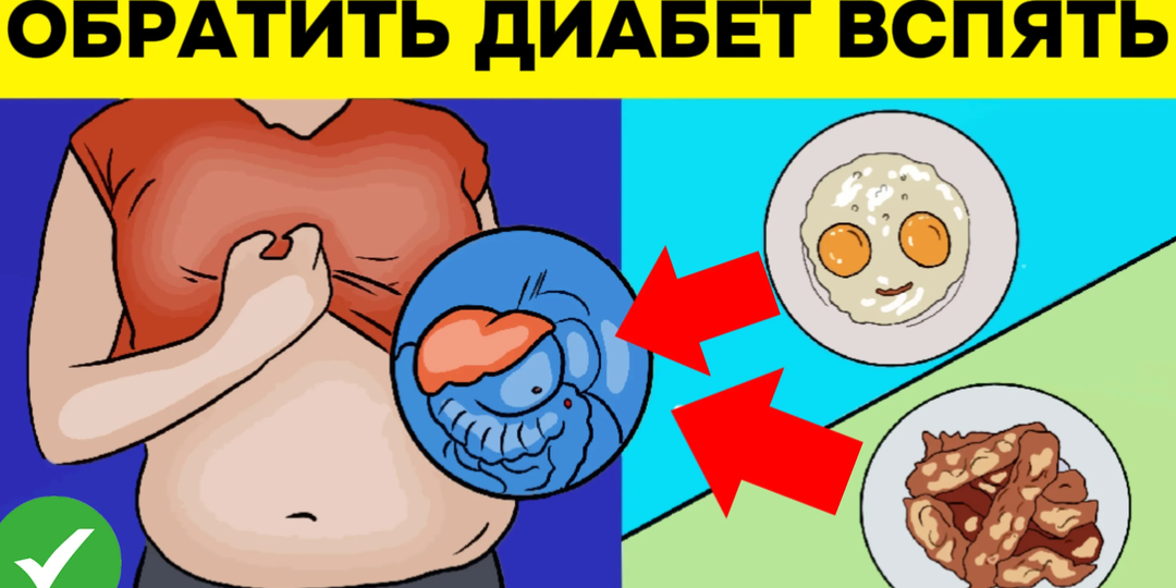 7 продуктов, которые, по мнению врачей, полезны людям с сахарным диабетом