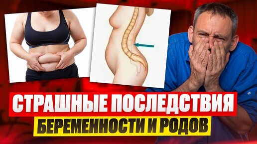 Descargar video: СТРАШНЫЕ ПОСЛЕДСТВИЯ беременности и родов для организма женщины