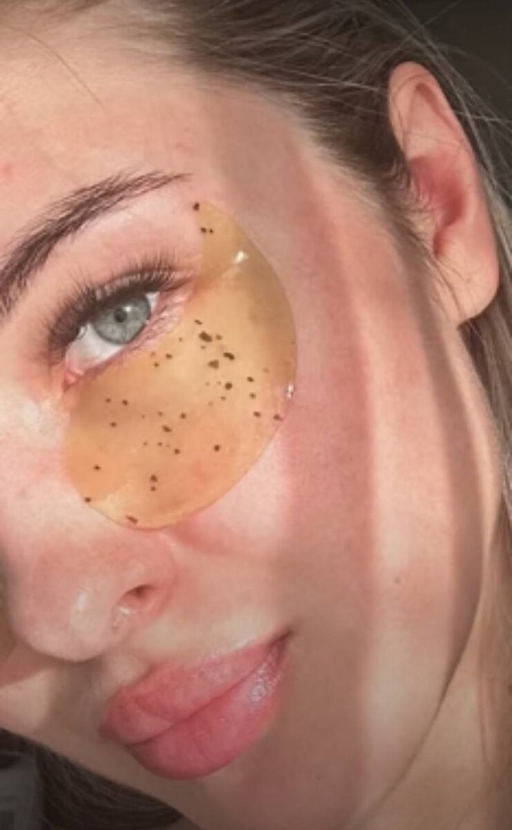 Нанесение патчей - капелькой внутрь, при отечности