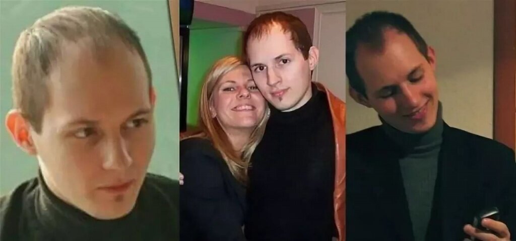 Павел дуров в молодости фото до пластики
