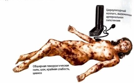 Инфекционные болезни с иллюстрациями Неттера, 2021