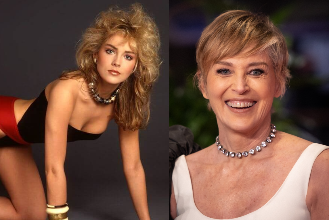 Американская актриса Шерон Стоун (1958 г. рожд.) С детства страдает сахарным диабетом 1-ого типа.