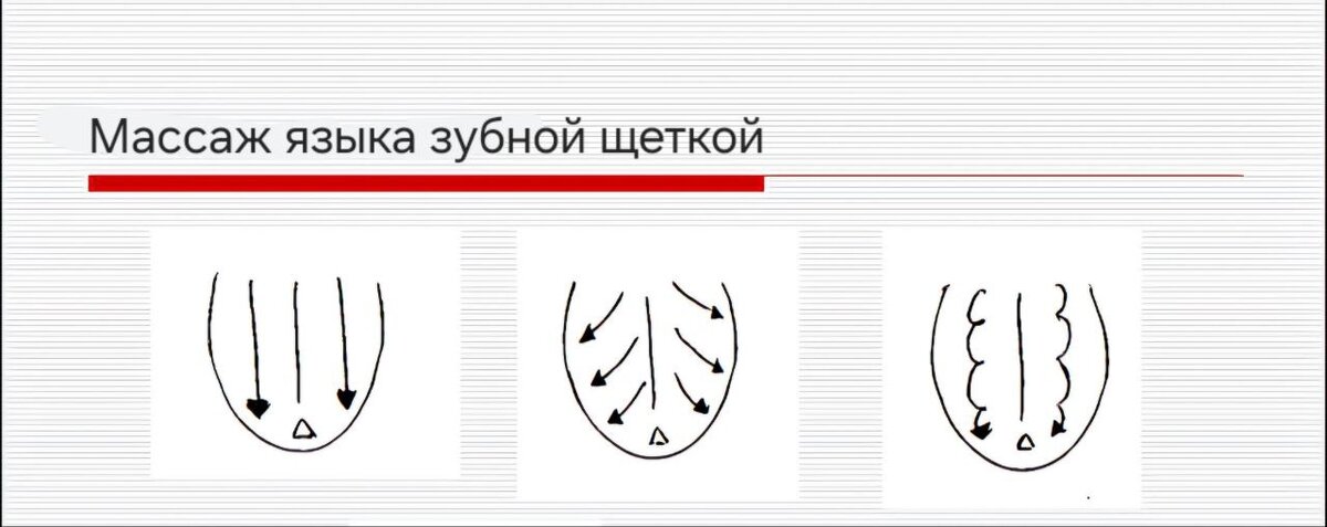 Схема массажа языка зубной щеткой