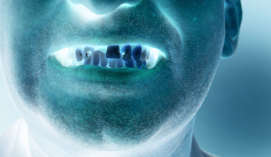 Проблемы с зубами у наркоманов