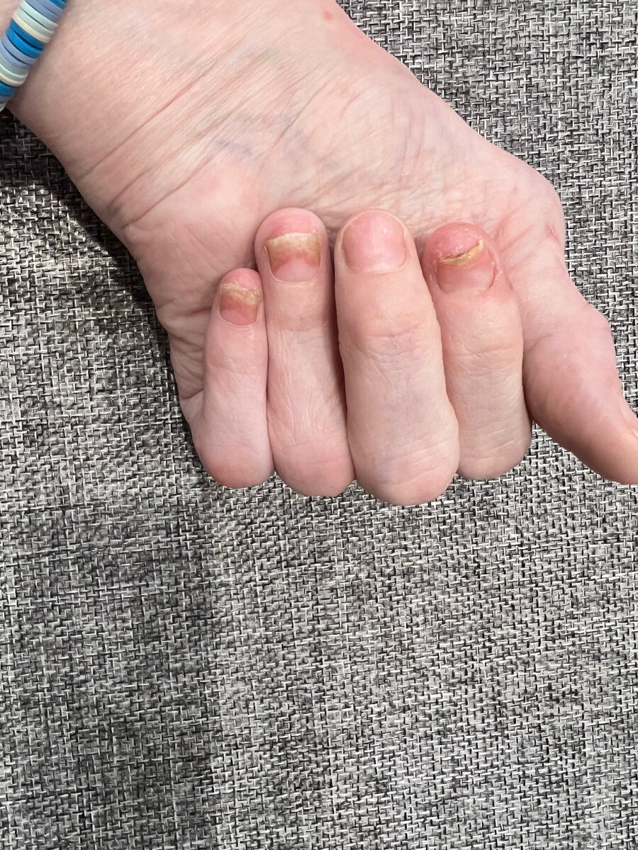 Всем привет! Наконец-то я решила рассказать Вам о своей недавней проблеме - испорченные ногти!