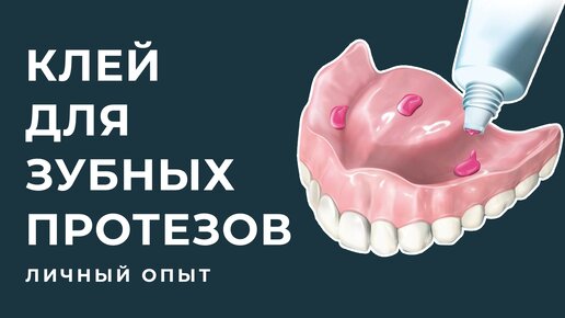 37. Dentures/Съемные зубные протезы: Клей для зубных протезов. | Irina ...