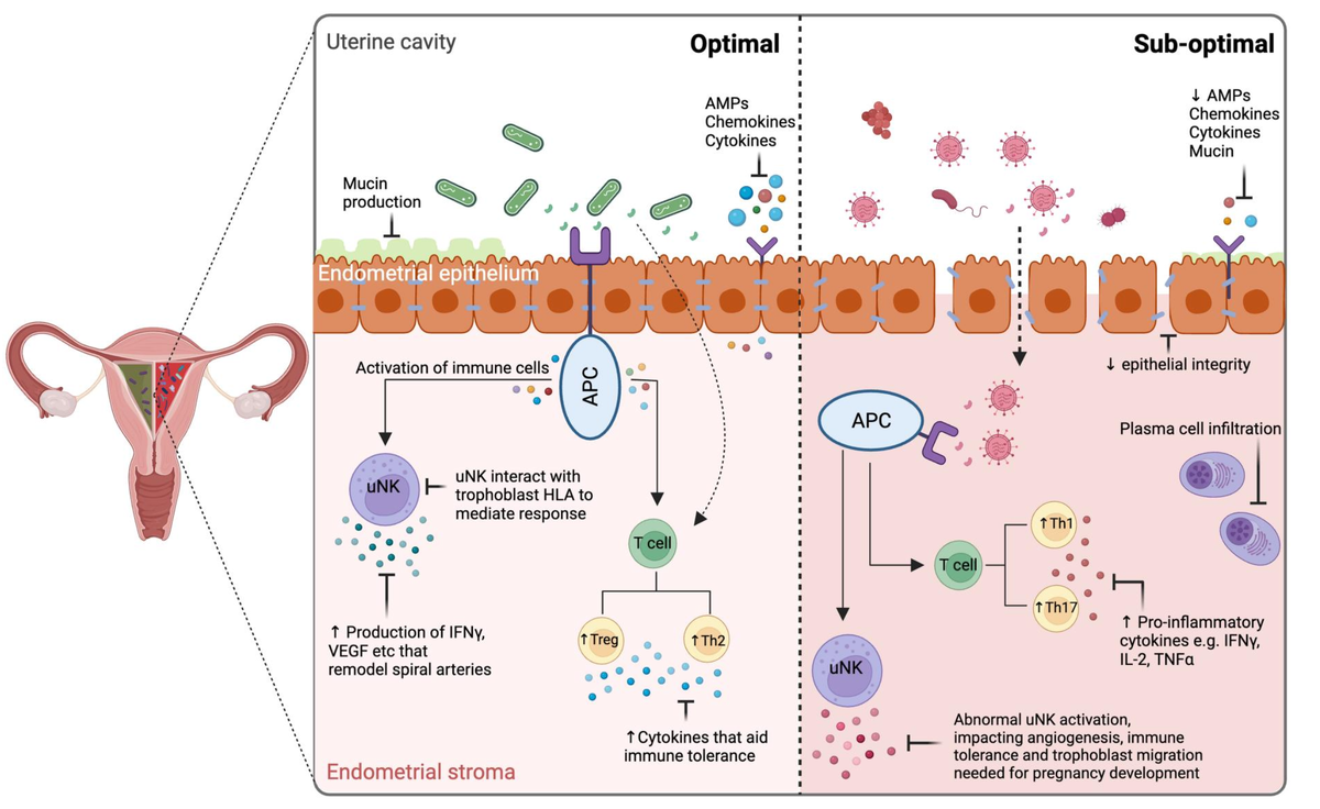 В оптимальном состоянии низкий уровень бактерий-комменсалов способствует иммунному и воспалительному ответу хозяина, поддерживающему функцию эндометрия. Эпителиальные клетки вырабатывают антимикробные пептиды (AMPs), хемокины и цитокины, помогая поддерживать целостность эпителия и отталкивать потенциальные патогенные бактерии (Yarbrough et al., 2015). Бактерии-комменсалы и их метаболиты взаимодействуют с антигенпрезентирующими клетками (APCs) для модуляции иммунной толерантности, включая формирование специфических Т-клеток, таких как регуляторные Т-клетки (Treg), и трансформацию Th1 в Th2-клетки (Tsuda et al., 2019; Zhu et al., 2022). Th2-клетки секретируют IL-4, IL-6, IL-10 и IL-13, которые важны для цитокинового гемостаза и резистентности к патогенам (D'Ippolito et al., 2018; Tsuda et al, 2019), в то время как маточные естественные клетки-киллеры (uNK) взаимодействуют с HLA трофобласта для модуляции иммунной толерантности и секретируют интерферон (IFN)-c и фактор роста эндотелия сосудов (VEGF), которые участвуют в ремоделировании спиральных артерий для нормальной плацентации (Brosens et al., 2022; Faas and de Vos, 2017; Papuchova et al., 2019). Сдвиг в сторону дисбиотической микробиоты эндометрия и усиление колонизации патогенами может привести к снижению выработки AMP, хемокинов и цитокинов, что приведет к потере целостности эпителия, повышению проницаемости и транслокации бактерий (Benner et al., 2018). Ненормально активированные APC приводят к аберрантной активации иммунных путей, включая изменения в производстве Т-клеток, приводящие к увеличению доли Th17 и трансформации Th2 в Th1 клетки, что приводит к увеличению производства фактора некроза опухоли (TNF)-a, который был связан с аномальным развитием беременности (D'Ippolito et al., 2018). Измененная стимуляция uNK может влиять на ангиогенез и иммунную толерантность плода и матери (Brosens et al., 2022), а плазматические клетки в строме эндометрия могут отражать иммунный ответ на патогены и нарушать восприимчивость эндометрия (Buzzaccarini et al., 2020; Teng et al., 2012).