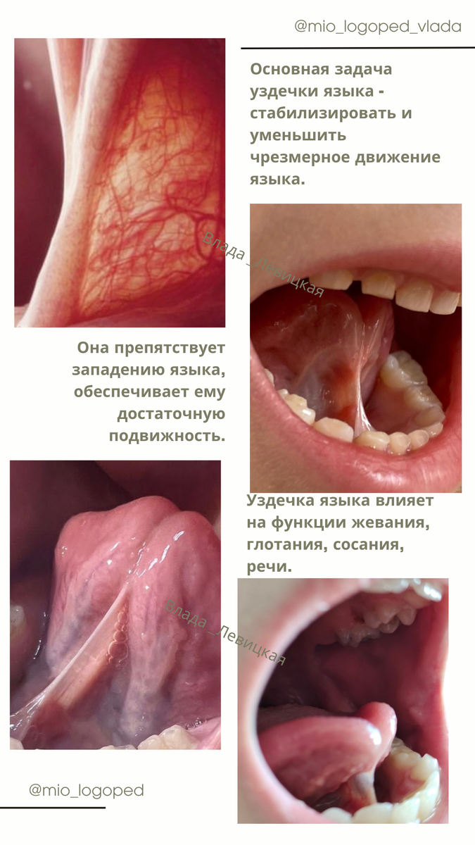 https://vk.com/mio_logoped_vlada 