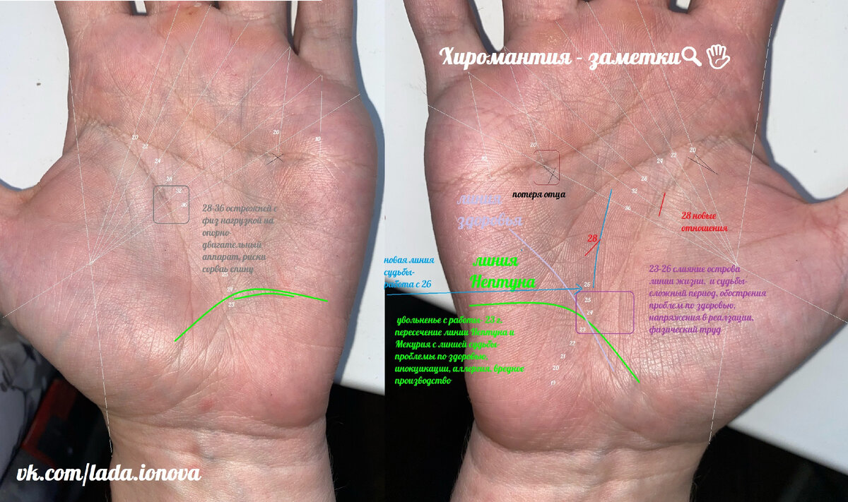 Рассмотрим руки слабослышашего мужчины | Хиромантия - заметки🔍🖐🏻 | Дзен