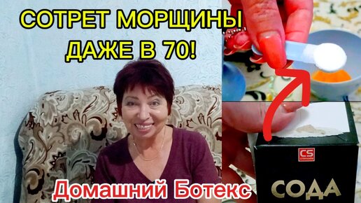 СИЛЬНЕЙШЕЕ ОТ МОРЩИН И ПЯТЕН!Обычная СОДА Убирает 90% МОРЩИН и в 70 лет!!!1-2 раза в неделю!