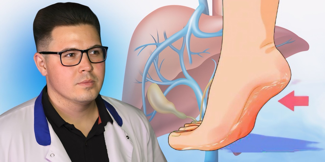 Ноги расскажут о печени: от неприятного запаха до трещин. 5 неочевидных признаков связи